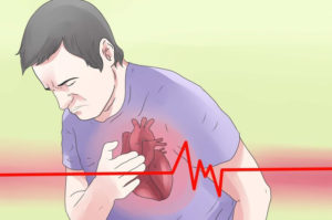 aid4427220-728px-Spot-Symptoms-of-Coronary-Heart-Disease-Step-1